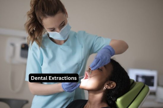 Dental Extractions