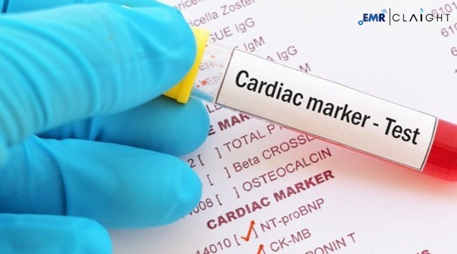 Global Cardiac Biomarker Testing Market