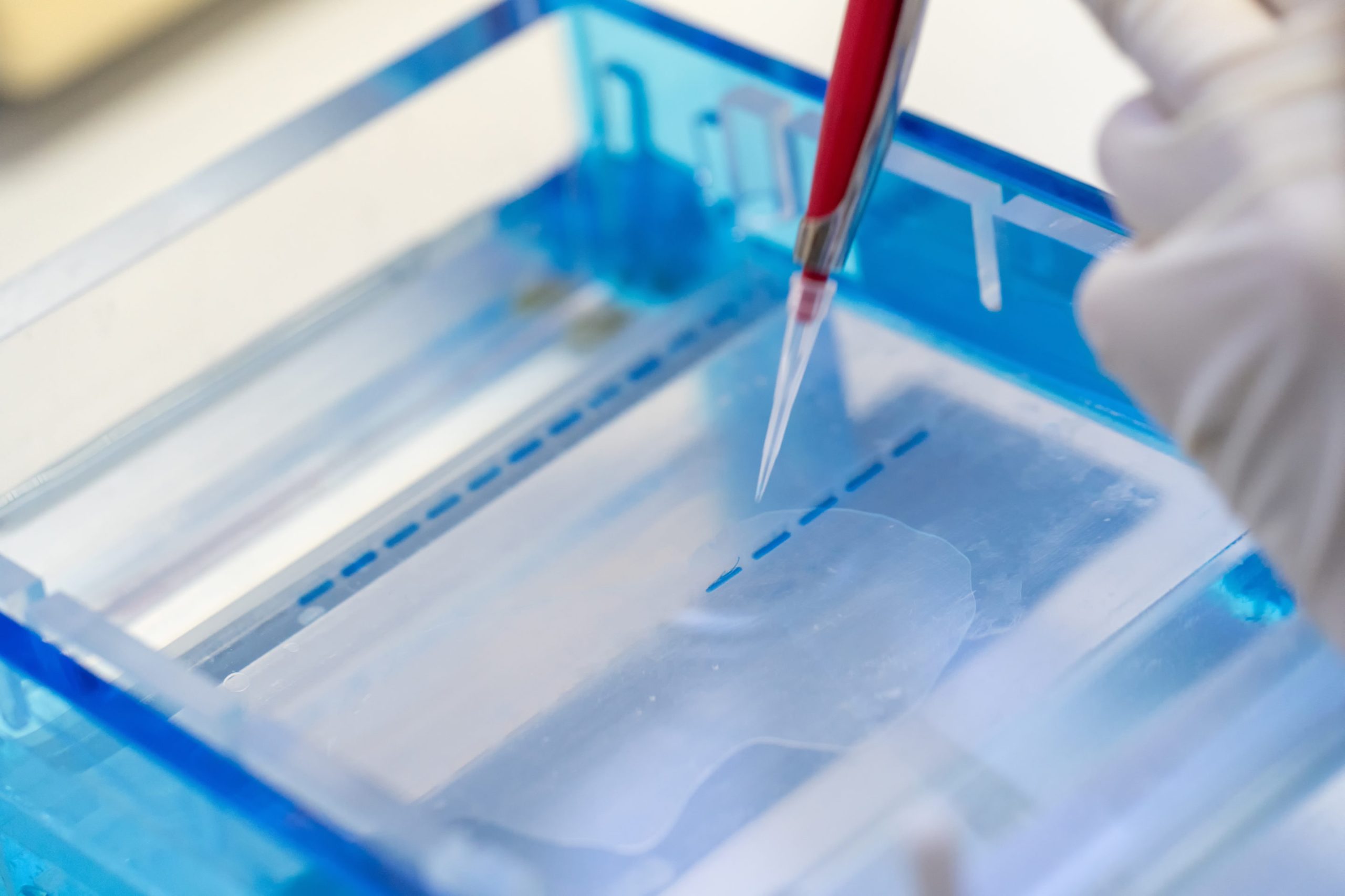 Western Blot Phosphorylated Proteins