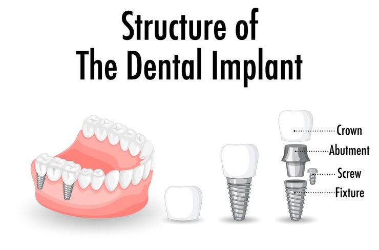 structure-dental-implant-white-background_1308-108997