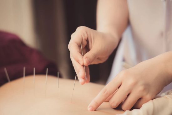 Chronic Pain Acupuncture Treatment,