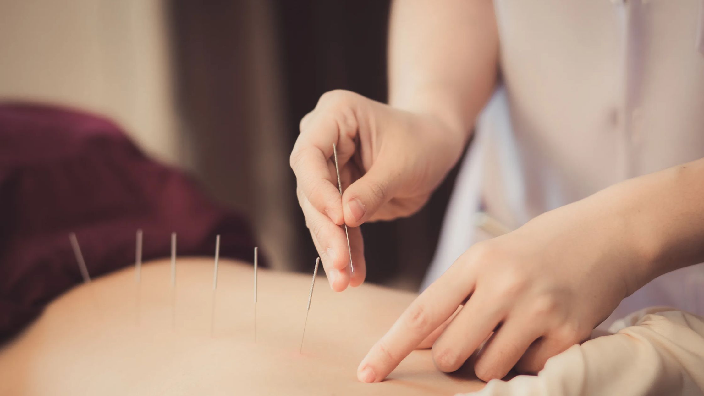 Chronic Pain Acupuncture Treatment,