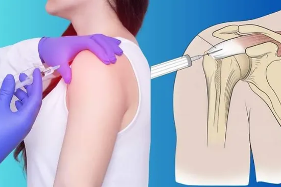 Injections for Shoulder Pain What