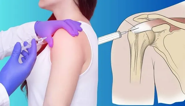 Injections for Shoulder Pain What