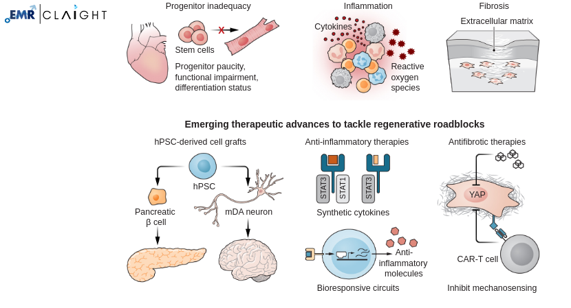 Regenerative Medicine Market