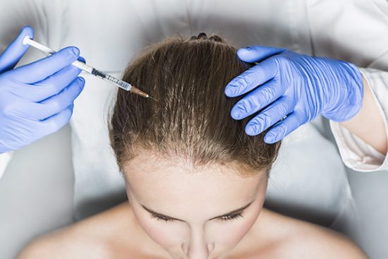 prp hair treatment dubai